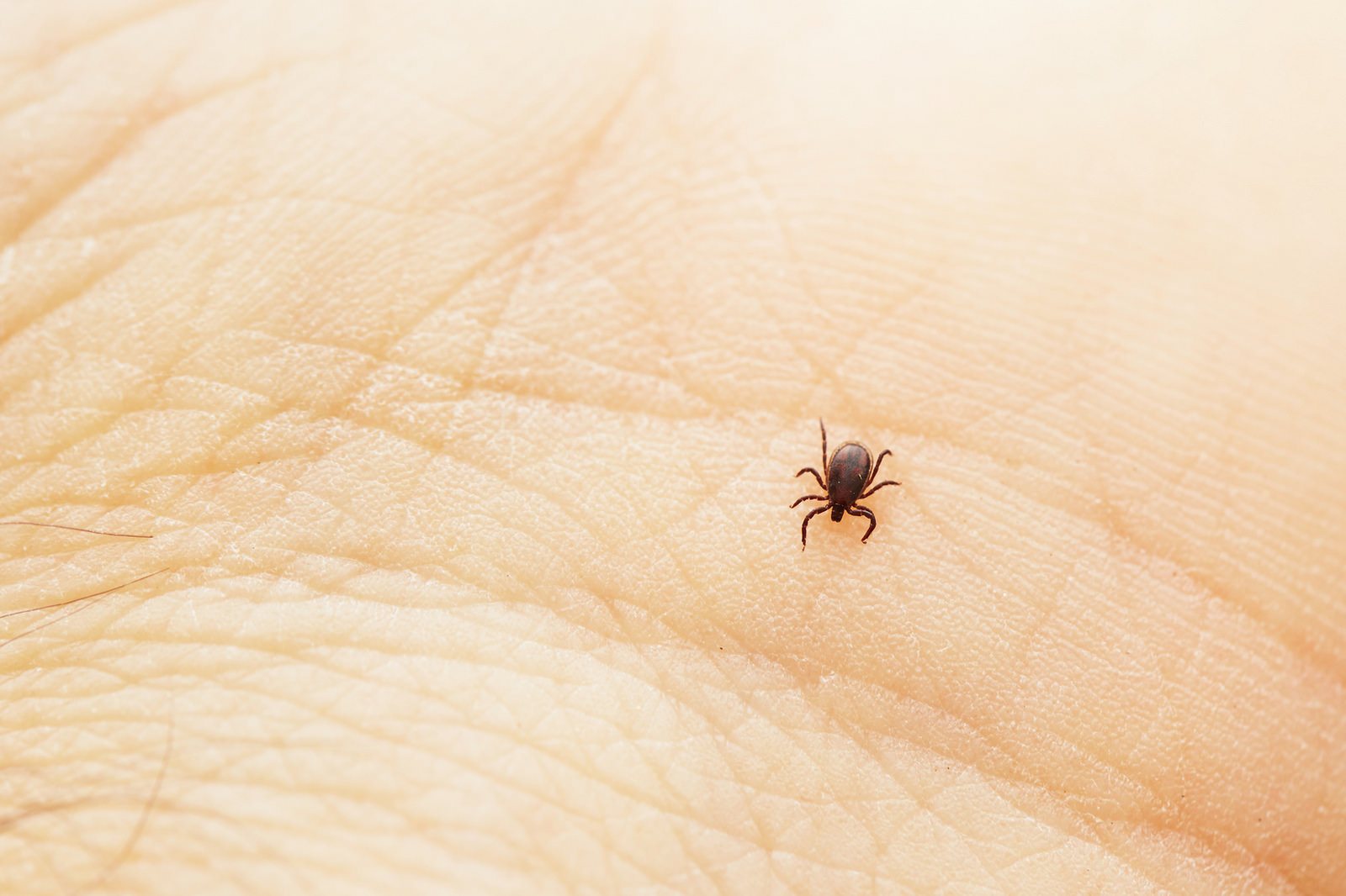 Lyme Disease: Woman Spends 12 Years Of Ineffective Treatments