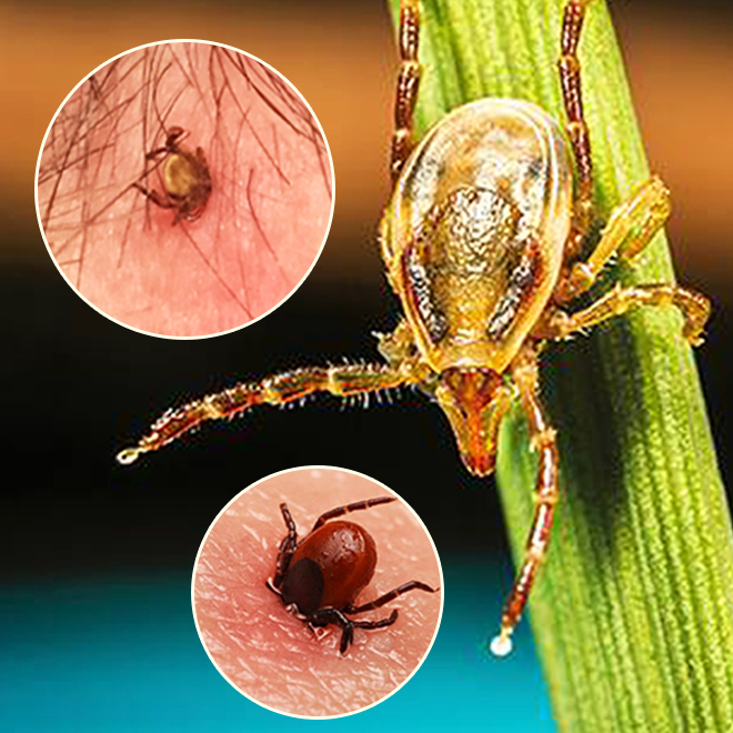 Removing A Tick: The Important Safety Tips